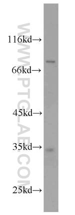 DARPP32 Antibody in Western Blot (WB)