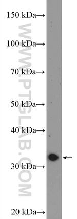 DARPP32 Antibody in Western Blot (WB)