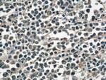 RHOA Antibody in Immunohistochemistry (Paraffin) (IHC (P))