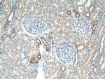 RHOA Antibody in Immunohistochemistry (Paraffin) (IHC (P))