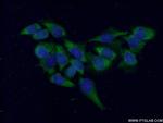 RHOA Antibody in Immunocytochemistry (ICC/IF)