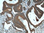 RHOA Antibody in Immunohistochemistry (Paraffin) (IHC (P))