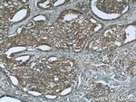 CNOT8 Antibody in Immunohistochemistry (Paraffin) (IHC (P))