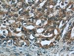 CNOT8 Antibody in Immunohistochemistry (Paraffin) (IHC (P))