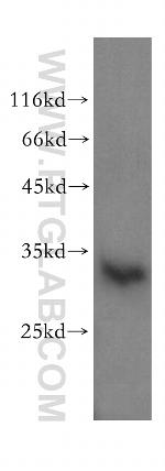 CNOT8 Antibody in Western Blot (WB)