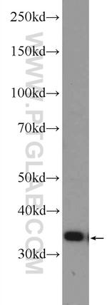 CNOT8 Antibody in Western Blot (WB)