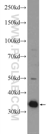 CNOT8 Antibody in Western Blot (WB)