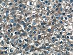 GUK1 Antibody in Immunohistochemistry (Paraffin) (IHC (P))