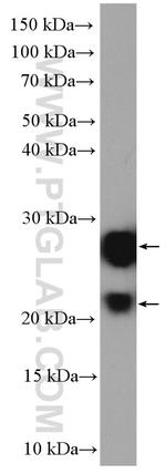 GUK1 Antibody in Western Blot (WB)