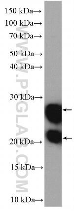 GUK1 Antibody in Western Blot (WB)