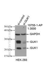 GUK1 Antibody in Western Blot (WB)