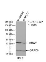 AHCY Antibody in Western Blot (WB)