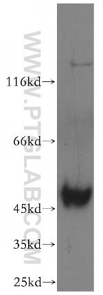 AHCY Antibody in Western Blot (WB)