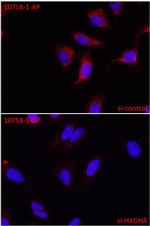 HADHA Antibody in Immunocytochemistry (ICC/IF)