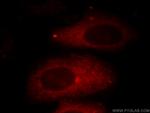 HADHA Antibody in Immunocytochemistry (ICC/IF)