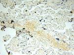 HADHA Antibody in Immunohistochemistry (Paraffin) (IHC (P))