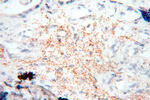 HADHA Antibody in Immunohistochemistry (Paraffin) (IHC (P))