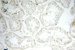 HADHA Antibody in Immunohistochemistry (Paraffin) (IHC (P))