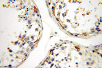 HADHA Antibody in Immunohistochemistry (Paraffin) (IHC (P))