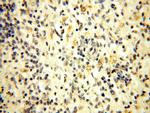 HADHA Antibody in Immunohistochemistry (Paraffin) (IHC (P))