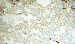 HADHA Antibody in Immunohistochemistry (Paraffin) (IHC (P))