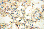 HADHA Antibody in Immunohistochemistry (Paraffin) (IHC (P))