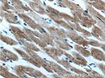 HADHA Antibody in Immunohistochemistry (Paraffin) (IHC (P))