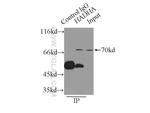 HADHA Antibody in Immunoprecipitation (IP)