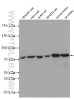 HADHA Antibody in Western Blot (WB)