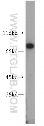 HADHA Antibody in Western Blot (WB)