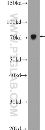 HADHA Antibody in Western Blot (WB)