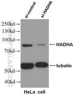 HADHA Antibody in Western Blot (WB)