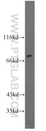 HADHA Antibody in Western Blot (WB)