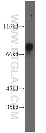 HADHA Antibody in Western Blot (WB)