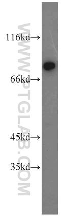 HADHA Antibody in Western Blot (WB)