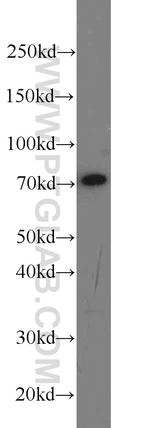 HADHA Antibody in Western Blot (WB)