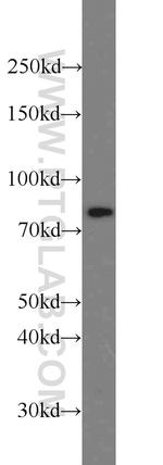 HADHA Antibody in Western Blot (WB)