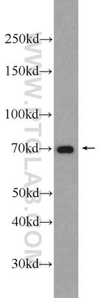 HADHA Antibody in Western Blot (WB)