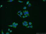 SND1 Antibody in Immunocytochemistry (ICC/IF)