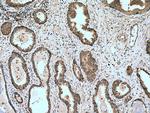 CDK1 Antibody in Immunohistochemistry (Paraffin) (IHC (P))