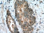 CDK1 Antibody in Immunohistochemistry (Paraffin) (IHC (P))