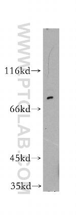 GSPT1 Antibody in Western Blot (WB)