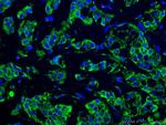 GTPBP3 Antibody in Immunohistochemistry (PFA fixed) (IHC (PFA))