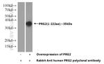 PRG2 Antibody in Western Blot (WB)