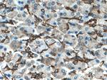 SEPT9 Antibody in Immunohistochemistry (Paraffin) (IHC (P))