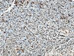 SEPT9 Antibody in Immunohistochemistry (Paraffin) (IHC (P))