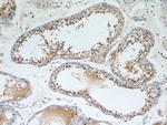 SEPT9 Antibody in Immunohistochemistry (Paraffin) (IHC (P))