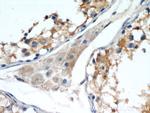 SEPT9 Antibody in Immunohistochemistry (Paraffin) (IHC (P))