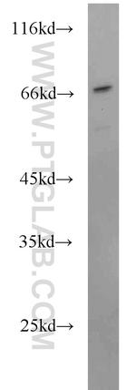 SEPT9 Antibody in Western Blot (WB)