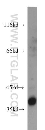 SEPT9 Antibody in Western Blot (WB)